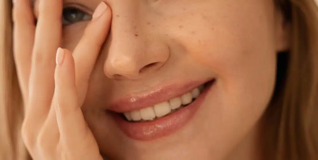Kleresca ® for active acne or rosacea