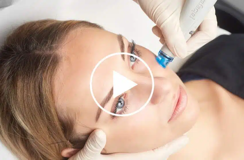 Hydrafacial